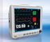 NIBP قياس آلة مراقبة المريض مع وظيفة إدارة إدخال معلومات المريض
